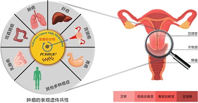 全癌标志物将肿瘤筛查提前到“未癌”阶段